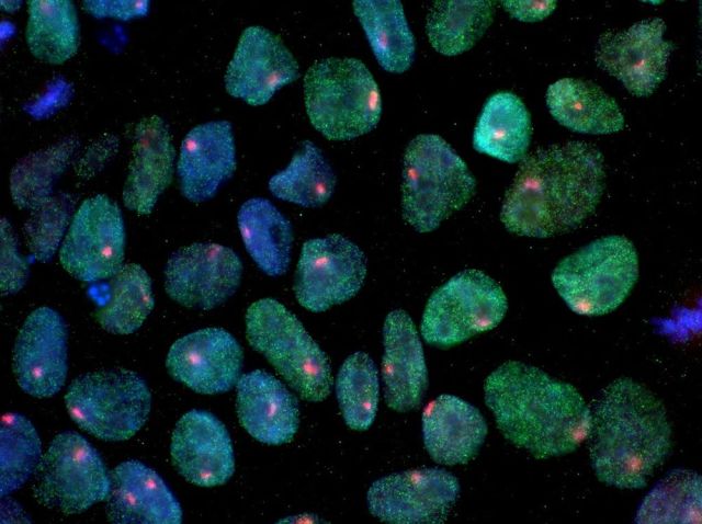 induced-pluripotent-stem-cells-human.jpg